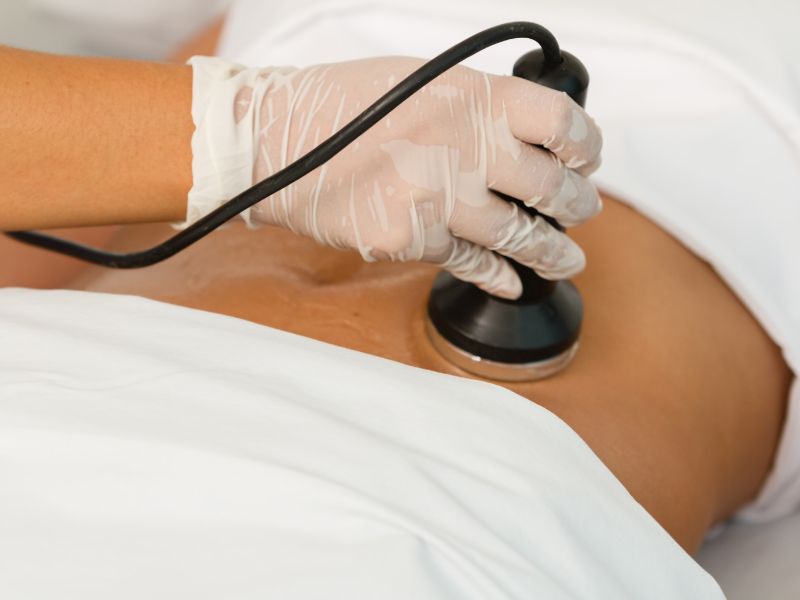 eliminar grasa sin cirugia